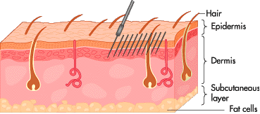 dermal.gif (20552 bytes)